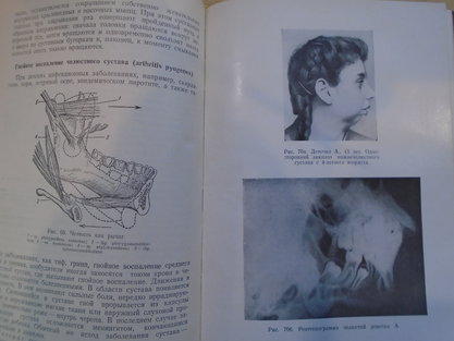 Агапов Н.И. Клиническая стоматология детского возраста. Медгиз 1953. Москва